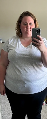 Before - 20-week transformation